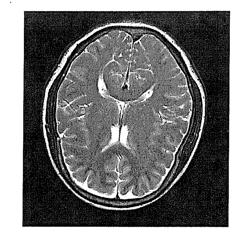 METHOD AND APPARATUS FOR MAGNETIC RESONANCE IMAGING PREVIEW AND ESTABLISHING AN MR MODEL