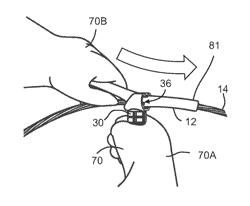 CONDUCTOR COVER APPLICATOR