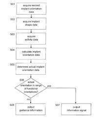 DETERMINATION OF AN IMPLANT ORIENTATION RELATIVE TO A BONE