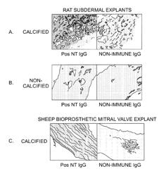 Oxidation resistant bioprosthetic tissues and preparation thereof