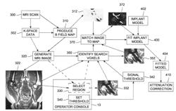 Method, apparatus, and article for pet attenuation correction utilizing MRI