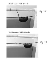 Compositions and methods of treating muscular dystrophy with thromboxane-A2 receptor antagonists