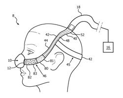 Gas carrying headgear with porous boundary membranes