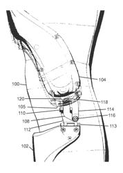 Steady ratio four-bar linkage for genuflective energy harvesting