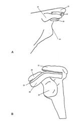 ORTHOPAEDIC SHOULDER IMPLANT