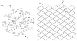 Uncaging stent