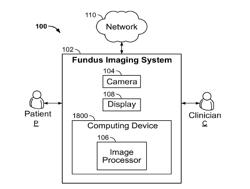 RETINAL IMAGE CAPTURING