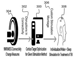 TRANSCRANIAL STIMULATION SYSTEM AND METHOD TO IMPROVE COGNITIVE FUNCTION AFTER TRAUMATIC BRAIN INJURY