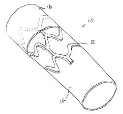 Methods for electrospin coating and laminating of endoluminal prostheses