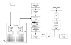 METHOD AND SYSTEM FOR ENHANCED ULTRASOUND IMAGE VISUALIZATION BY DETECTING AND REPLACING ACOUSTIC SHADOW ARTIFACTS