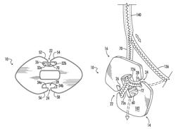 Suture button construct for surgical procedures