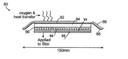 Continuous low irradiance photodynamic therapy light bandage