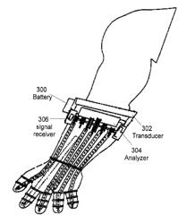 ARTIFICIAL BODY PART CONTROL SYSTEM USING ULTRASONIC IMAGING