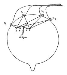 Noninvasive detection of human brain conditions and anomalies