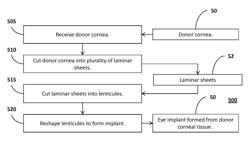 Corneal implant systems and methods