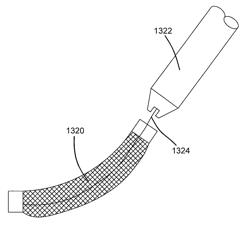 Segmented delivery system