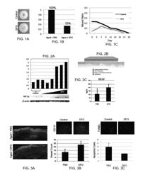 Topical and transdermal delivery of HIF-1 modulators to prevent and treat chronic wounds