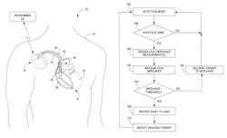 Lead integrity testing triggered by sensed asystole