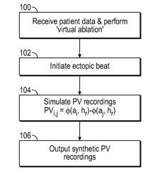 Detection of Conduction Gaps in a Pulmonary Vein