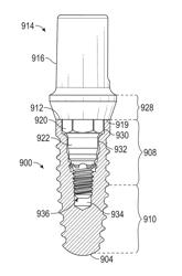 SURFACE TREATMENT FOR AN IMPLANT SURFACE