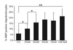 PRETERM INFANT FORMULA CONTAINING BUTYRATE AND USES THEREOF