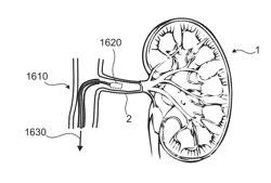 Systems and methods for treating cancer and/or augmenting organ function