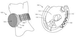 Antenna for appendage-worn miniature communications device