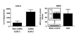 ATR-FTIR FOR NON-INVASIVE DETECTION OF COLITIS