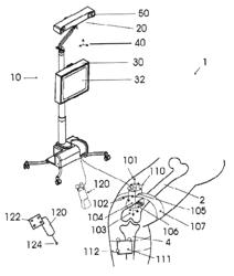 Ultrasonic bone motion tracking system