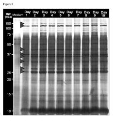 Proteomics Based Diagnostic Detection Method for Chronic Sinusitis