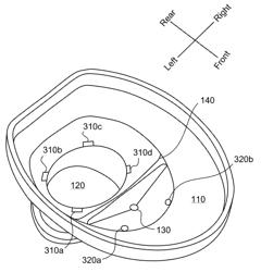 Split Toilet Bowl for Separating Fecal Matter and Urine for Collection and Analysis