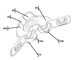 Sleep Apnea Treatment System and Improvements Thereto