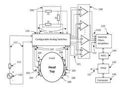 SCREENING OF MALIGNANT GLIOMA, BRAIN TUMORS, AND BRAIN INJURIES USING DISTURBANCE COEFFICIENT, DIFFERENTIAL IMPEDANCES, AND ARTIFICIAL NEURAL NETWORK