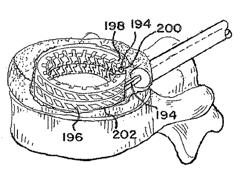 Devices For Treating The Spine