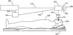 Methods and systems to provide excluded defined zones for increasing accommodative amplitude