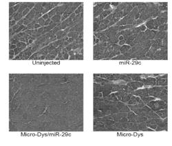 ADENO-ASSOCIATED VIRUS VECTOR DELIVERY OF MICRORNA-29 AND MICRO-DYSTROPHIN TO TREAT MUSCULAR DYSTROPHY