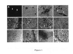 Mesenchymal stem cell-mediated function tooth regeneration