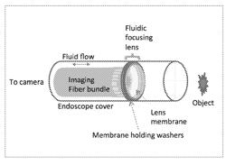 METHOD, SYSTEM, SOFTWARE, AND DEVICE FOR REMOTE, MIIATURIZED, AND THREE-DIMENSIONAL IMAGING AND ANALYSIS OF HUMAN LESIONS RESEARCH AND CLINICAL APPLICATIONS THEREOF