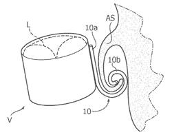 Implant device and implantation kit