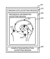 Medical image imaging device for positioning an imaging slice