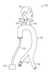 RECONSTITUTION OF POST MORTEM CIRCULATION, SPECIALIZED METHODS AND PROCEDURES