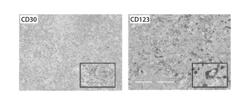 TREATMENT OF CANCER USING A CHIMERIC ANTIGEN RECEPTOR IN COMBINATION WITH AN INHIBITOR OF A PRO-M2 MACROPHAGE MOLECULE