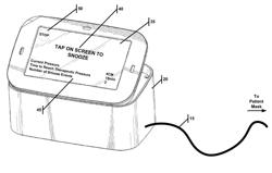 Methods and Systems for the Treatment of Sleep Apnea