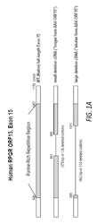 RPGR gene therapy for retinitis pigmentosa