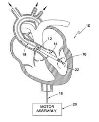 Guidable intravascular blood pump and related methods