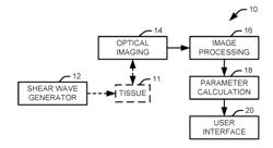 MEASUREMENT OF BIOMECHANICAL PROPERTIES OF TISSUE