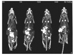 EXOSOMES FOR IMMUNO-ONCOLOGY AND ANTI-INFLAMMATORY THERAPY