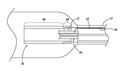 Ultrasound-based neuromodulation system