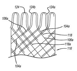 Woven stent device and manufacturing method