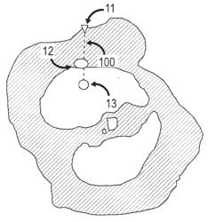 DYNAMIC PLANNING METHOD FOR NEEDLE INSERTION